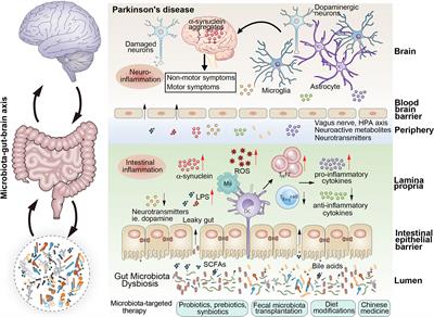 Gut Microbiota: A Novel Therapeutic Target for Parkinson’s Disease